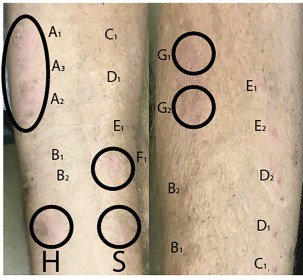 Scientist Calls for Polyethylene Glycol (PEG) Sensitivity Patch Testing Prior to COVID19 Vaccine and Drug Use